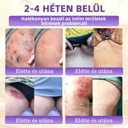 Magyarországról készült és szállított 👩‍⚕️🍉𝐆𝐥𝐢𝐦𝐦𝐞𝐫𝐥𝐲®𝐁𝐈𝐎𝐓𝐈𝐍 𝟏𝟎 𝐀𝐙 𝟏-𝐁𝐄𝐍 𝐁ő𝐫𝐫𝐞𝐠𝐞𝐧𝐞𝐫á𝐥ó 𝐊𝐫é𝐦 🔥