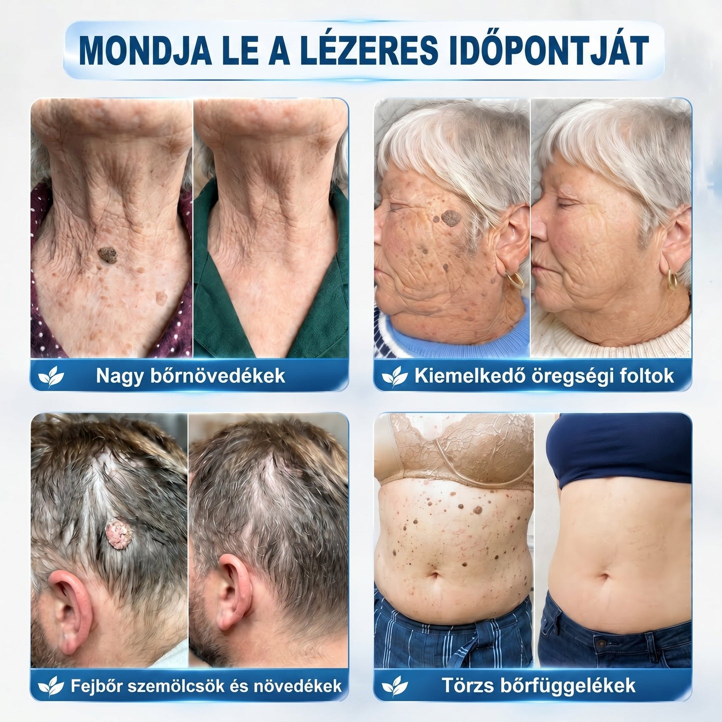 🍀🌈𝐏𝒊𝐜𝐝𝒐® 7 𝑵𝒂𝒑𝒐𝒔 𝑩ö𝒓𝒌𝒊𝒏ö𝒗é𝒔- É𝒔 𝑭𝒐𝒍𝒕𝒆𝒍𝒕á𝒗𝒐𝒍í𝒕ó(𝐹á𝑗𝑑𝑎𝑙𝑜𝑚 𝑛é𝑙𝑘ü𝑙, ℎ𝑒𝑔𝑒𝑘 𝑛é𝑙𝑘ü𝑙 – 𝑟𝑜𝑙𝑙𝑒𝑟𝑏𝑎𝑙𝑙)💪