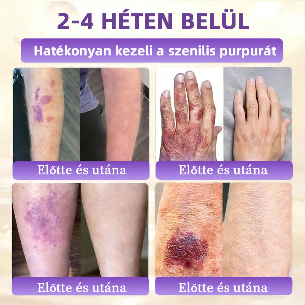 Magyarországról készült és szállított 👩‍⚕️🍉𝐆𝐥𝐢𝐦𝐦𝐞𝐫𝐥𝐲®𝐁𝐈𝐎𝐓𝐈𝐍 𝟏𝟎 𝐀𝐙 𝟏-𝐁𝐄𝐍 𝐁ő𝐫𝐫𝐞𝐠𝐞𝐧𝐞𝐫á𝐥ó 𝐊𝐫é𝐦 🔥