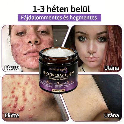 Magyarországról készült és szállított 👩‍⚕️🍉𝐆𝐥𝐢𝐦𝐦𝐞𝐫𝐥𝐲®𝐁𝐈𝐎𝐓𝐈𝐍 𝟏𝟎 𝐀𝐙 𝟏-𝐁𝐄𝐍 𝐁ő𝐫𝐫𝐞𝐠𝐞𝐧𝐞𝐫á𝐥ó 𝐊𝐫é𝐦 🔥