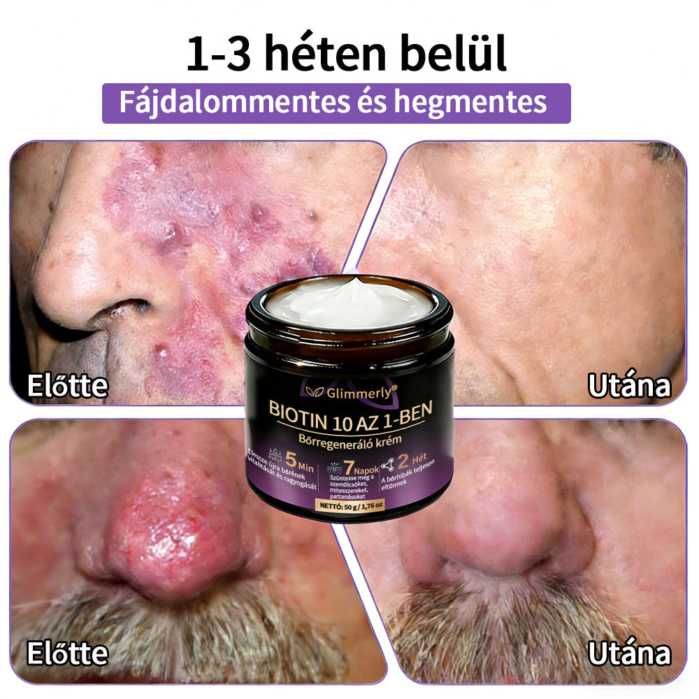 Magyarországról készült és szállított 👩‍⚕️🍉𝐆𝐥𝐢𝐦𝐦𝐞𝐫𝐥𝐲®𝐁𝐈𝐎𝐓𝐈𝐍 𝟏𝟎 𝐀𝐙 𝟏-𝐁𝐄𝐍 𝐁ő𝐫𝐫𝐞𝐠𝐞𝐧𝐞𝐫á𝐥ó 𝐊𝐫é𝐦 🔥