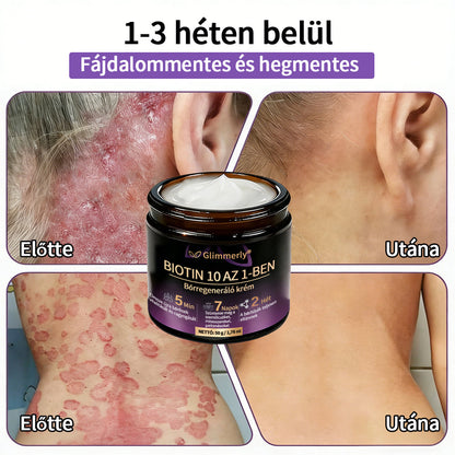 Magyarországról készült és szállított 👩‍⚕️🍉𝐆𝐥𝐢𝐦𝐦𝐞𝐫𝐥𝐲®𝐁𝐈𝐎𝐓𝐈𝐍 𝟏𝟎 𝐀𝐙 𝟏-𝐁𝐄𝐍 𝐁ő𝐫𝐫𝐞𝐠𝐞𝐧𝐞𝐫á𝐥ó 𝐊𝐫é𝐦 🔥