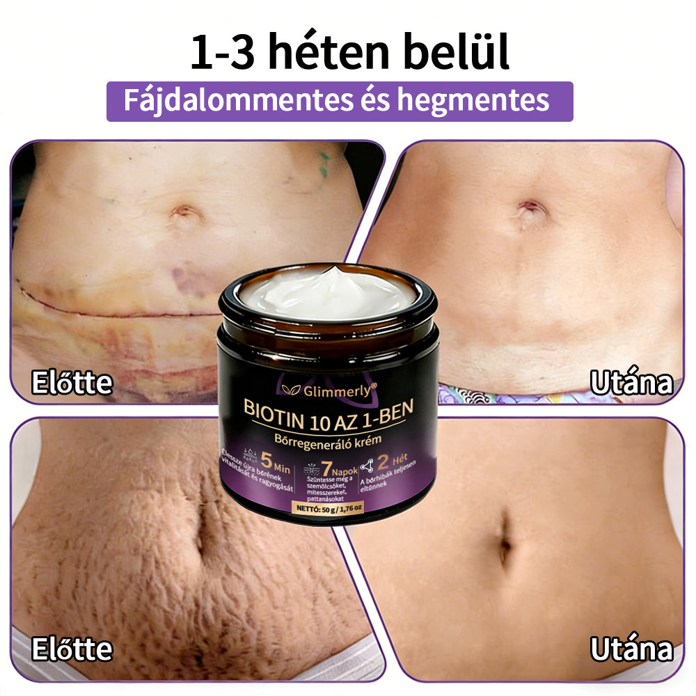 Magyarországról készült és szállított 👩‍⚕️🍉𝐆𝐥𝐢𝐦𝐦𝐞𝐫𝐥𝐲®𝐁𝐈𝐎𝐓𝐈𝐍 𝟏𝟎 𝐀𝐙 𝟏-𝐁𝐄𝐍 𝐁ő𝐫𝐫𝐞𝐠𝐞𝐧𝐞𝐫á𝐥ó 𝐊𝐫é𝐦 🔥