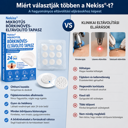 👩‍⚕️🎉 𝑯𝒊𝒗𝒂𝒕𝒂𝒍𝒐𝒔 á𝒓𝒖𝒉á𝒛 | 𝑵𝐞𝒌𝐢𝐬𝐬® 🌿 𝑴𝒊𝒌𝒓𝒐𝒕ű𝒔 𝑯𝒊𝒃á𝒕𝒍𝒂𝒏 𝑩ő𝒓 𝑩ő𝒓𝒌𝒊𝒏ö𝒗é𝒔-𝑬𝒍𝒕á𝒗𝒐𝒍í𝒕ó 𝑻𝒂𝒑𝒂𝒔𝒛 (𝑩ő𝒓𝒌𝒊𝒏ö𝒗é𝒔𝒆𝒌, 𝒂𝒑𝒓ó 𝒃ő𝒓𝒌𝒊𝒏ö𝒗é𝒔𝒆𝒌, 𝒔𝒛𝒆𝒎ö𝒍𝒄𝒔ö𝒌, 𝒂𝒏𝒚𝒂𝒋𝒆𝒈𝒚𝒆𝒌, ö𝒓𝒆𝒈𝒔é𝒈𝒊 𝒇𝒐𝒍𝒕𝒐𝒌 é𝒔 𝒑𝒊𝒈𝒎𝒆𝒏𝒕á𝒄𝒊ó𝒔 𝒑𝒓𝒐𝒃𝒍é𝒎á𝒌 𝒆𝒔𝒆𝒕é𝒏)