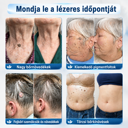 👩‍⚕️🎉 𝑯𝒊𝒗𝒂𝒕𝒂𝒍𝒐𝒔 á𝒓𝒖𝒉á𝒛 | 𝑵𝐞𝒌𝐢𝐬𝐬® 🌿 𝑴𝒊𝒌𝒓𝒐𝒕ű𝒔 𝑯𝒊𝒃á𝒕𝒍𝒂𝒏 𝑩ő𝒓 𝑩ő𝒓𝒌𝒊𝒏ö𝒗é𝒔-𝑬𝒍𝒕á𝒗𝒐𝒍í𝒕ó 𝑻𝒂𝒑𝒂𝒔𝒛 (𝑩ő𝒓𝒌𝒊𝒏ö𝒗é𝒔𝒆𝒌, 𝒂𝒑𝒓ó 𝒃ő𝒓𝒌𝒊𝒏ö𝒗é𝒔𝒆𝒌, 𝒔𝒛𝒆𝒎ö𝒍𝒄𝒔ö𝒌, 𝒂𝒏𝒚𝒂𝒋𝒆𝒈𝒚𝒆𝒌, ö𝒓𝒆𝒈𝒔é𝒈𝒊 𝒇𝒐𝒍𝒕𝒐𝒌 é𝒔 𝒑𝒊𝒈𝒎𝒆𝒏𝒕á𝒄𝒊ó𝒔 𝒑𝒓𝒐𝒃𝒍é𝒎á𝒌 𝒆𝒔𝒆𝒕é𝒏)