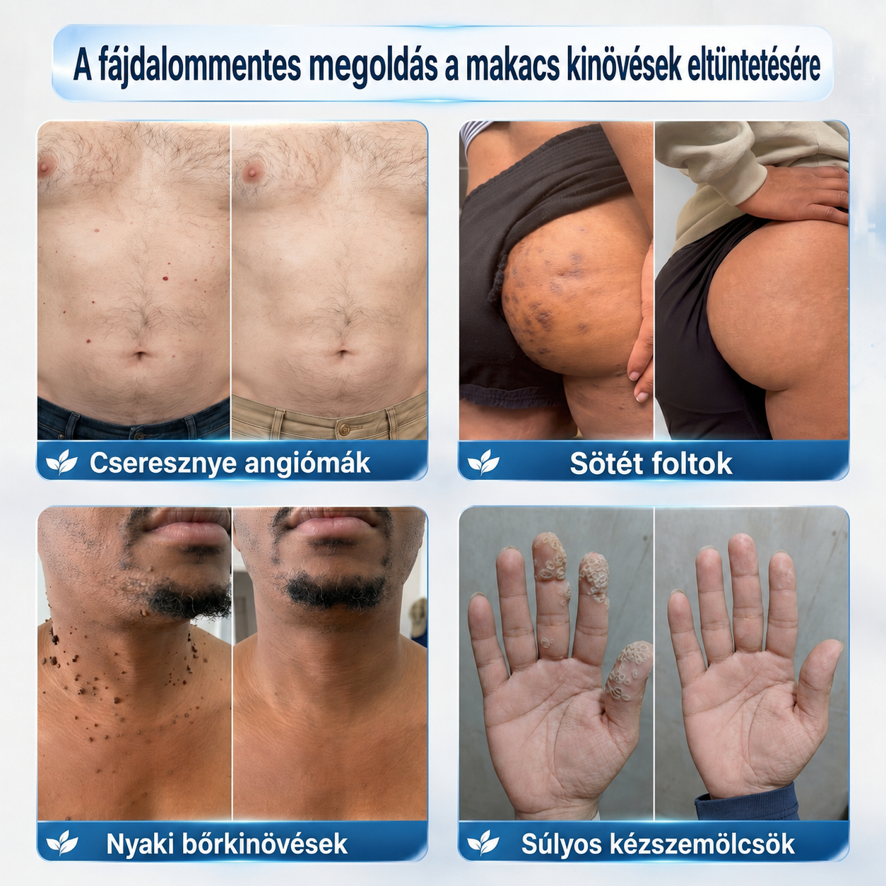 👩‍⚕️🎉 𝑯𝒊𝒗𝒂𝒕𝒂𝒍𝒐𝒔 á𝒓𝒖𝒉á𝒛 | 𝑵𝐞𝒌𝐢𝐬𝐬® 🌿 𝑴𝒊𝒌𝒓𝒐𝒕ű𝒔 𝑯𝒊𝒃á𝒕𝒍𝒂𝒏 𝑩ő𝒓 𝑩ő𝒓𝒌𝒊𝒏ö𝒗é𝒔-𝑬𝒍𝒕á𝒗𝒐𝒍í𝒕ó 𝑻𝒂𝒑𝒂𝒔𝒛 (𝑩ő𝒓𝒌𝒊𝒏ö𝒗é𝒔𝒆𝒌, 𝒂𝒑𝒓ó 𝒃ő𝒓𝒌𝒊𝒏ö𝒗é𝒔𝒆𝒌, 𝒔𝒛𝒆𝒎ö𝒍𝒄𝒔ö𝒌, 𝒂𝒏𝒚𝒂𝒋𝒆𝒈𝒚𝒆𝒌, ö𝒓𝒆𝒈𝒔é𝒈𝒊 𝒇𝒐𝒍𝒕𝒐𝒌 é𝒔 𝒑𝒊𝒈𝒎𝒆𝒏𝒕á𝒄𝒊ó𝒔 𝒑𝒓𝒐𝒃𝒍é𝒎á𝒌 𝒆𝒔𝒆𝒕é𝒏)