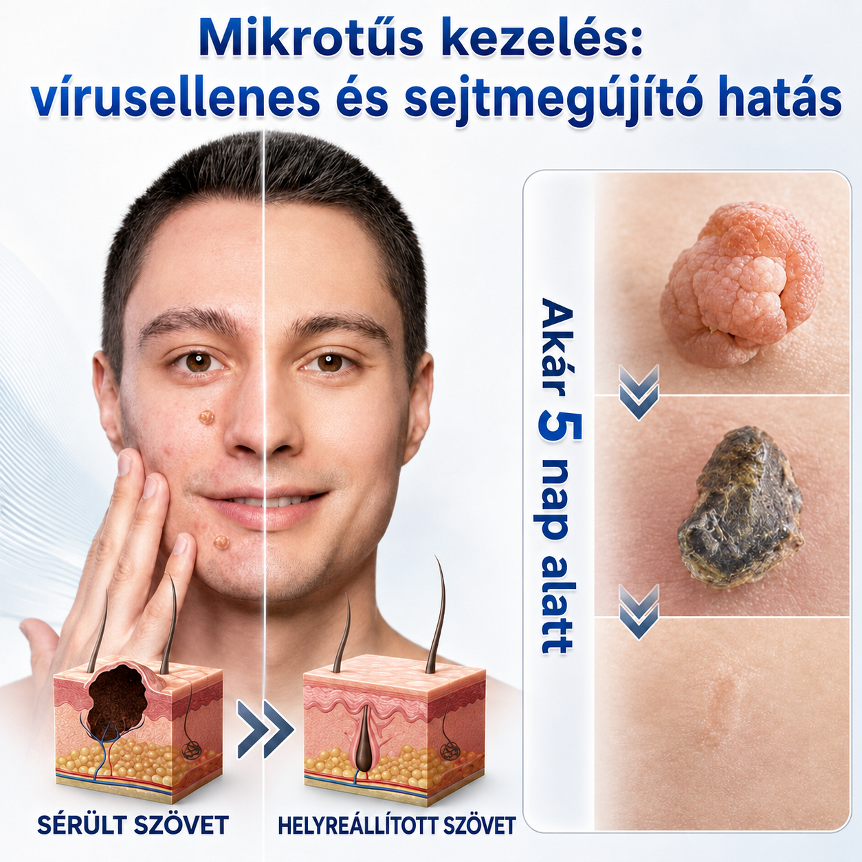 👩‍⚕️🎉 𝑯𝒊𝒗𝒂𝒕𝒂𝒍𝒐𝒔 á𝒓𝒖𝒉á𝒛 | 𝑵𝐞𝒌𝐢𝐬𝐬® 🌿 𝑴𝒊𝒌𝒓𝒐𝒕ű𝒔 𝑯𝒊𝒃á𝒕𝒍𝒂𝒏 𝑩ő𝒓 𝑩ő𝒓𝒌𝒊𝒏ö𝒗é𝒔-𝑬𝒍𝒕á𝒗𝒐𝒍í𝒕ó 𝑻𝒂𝒑𝒂𝒔𝒛 (𝑩ő𝒓𝒌𝒊𝒏ö𝒗é𝒔𝒆𝒌, 𝒂𝒑𝒓ó 𝒃ő𝒓𝒌𝒊𝒏ö𝒗é𝒔𝒆𝒌, 𝒔𝒛𝒆𝒎ö𝒍𝒄𝒔ö𝒌, 𝒂𝒏𝒚𝒂𝒋𝒆𝒈𝒚𝒆𝒌, ö𝒓𝒆𝒈𝒔é𝒈𝒊 𝒇𝒐𝒍𝒕𝒐𝒌 é𝒔 𝒑𝒊𝒈𝒎𝒆𝒏𝒕á𝒄𝒊ó𝒔 𝒑𝒓𝒐𝒃𝒍é𝒎á𝒌 𝒆𝒔𝒆𝒕é𝒏)
