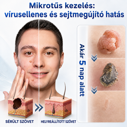 👩‍⚕️🎉 𝑯𝒊𝒗𝒂𝒕𝒂𝒍𝒐𝒔 á𝒓𝒖𝒉á𝒛 | 𝑵𝐞𝒌𝐢𝐬𝐬® 🌿 𝑴𝒊𝒌𝒓𝒐𝒕ű𝒔 𝑯𝒊𝒃á𝒕𝒍𝒂𝒏 𝑩ő𝒓 𝑩ő𝒓𝒌𝒊𝒏ö𝒗é𝒔-𝑬𝒍𝒕á𝒗𝒐𝒍í𝒕ó 𝑻𝒂𝒑𝒂𝒔𝒛 (𝑩ő𝒓𝒌𝒊𝒏ö𝒗é𝒔𝒆𝒌, 𝒂𝒑𝒓ó 𝒃ő𝒓𝒌𝒊𝒏ö𝒗é𝒔𝒆𝒌, 𝒔𝒛𝒆𝒎ö𝒍𝒄𝒔ö𝒌, 𝒂𝒏𝒚𝒂𝒋𝒆𝒈𝒚𝒆𝒌, ö𝒓𝒆𝒈𝒔é𝒈𝒊 𝒇𝒐𝒍𝒕𝒐𝒌 é𝒔 𝒑𝒊𝒈𝒎𝒆𝒏𝒕á𝒄𝒊ó𝒔 𝒑𝒓𝒐𝒃𝒍é𝒎á𝒌 𝒆𝒔𝒆𝒕é𝒏)