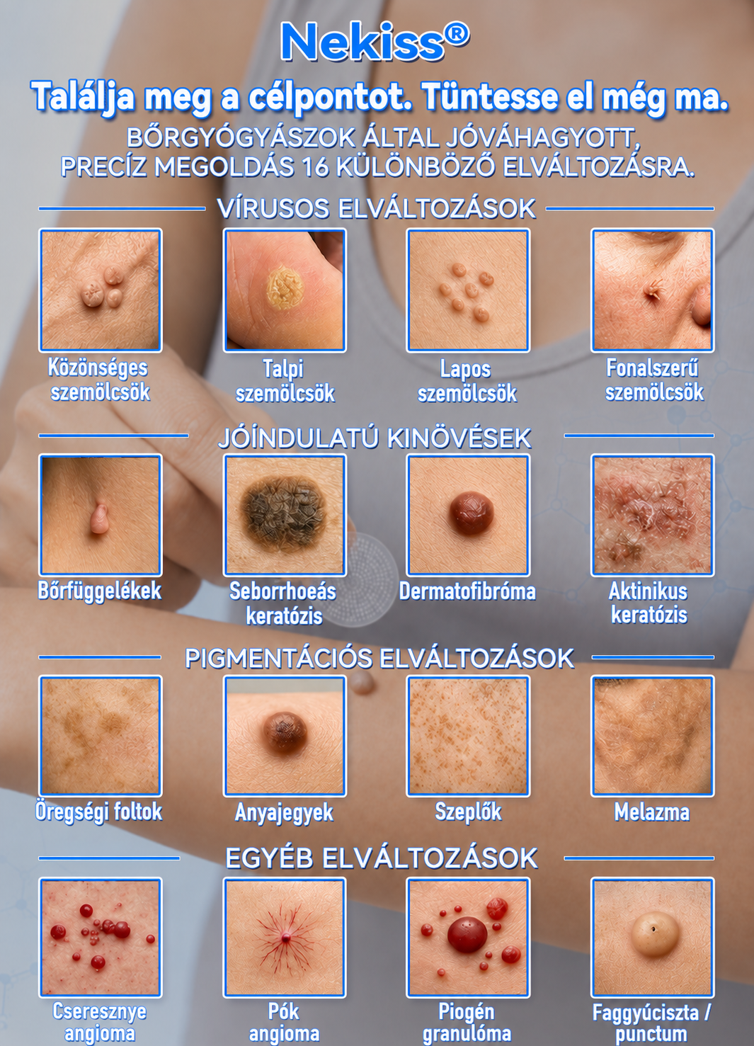 👩‍⚕️🎉 𝑯𝒊𝒗𝒂𝒕𝒂𝒍𝒐𝒔 á𝒓𝒖𝒉á𝒛 | 𝑵𝐞𝒌𝐢𝐬𝐬® 🌿 𝑴𝒊𝒌𝒓𝒐𝒕ű𝒔 𝑯𝒊𝒃á𝒕𝒍𝒂𝒏 𝑩ő𝒓 𝑩ő𝒓𝒌𝒊𝒏ö𝒗é𝒔-𝑬𝒍𝒕á𝒗𝒐𝒍í𝒕ó 𝑻𝒂𝒑𝒂𝒔𝒛 (𝑩ő𝒓𝒌𝒊𝒏ö𝒗é𝒔𝒆𝒌, 𝒂𝒑𝒓ó 𝒃ő𝒓𝒌𝒊𝒏ö𝒗é𝒔𝒆𝒌, 𝒔𝒛𝒆𝒎ö𝒍𝒄𝒔ö𝒌, 𝒂𝒏𝒚𝒂𝒋𝒆𝒈𝒚𝒆𝒌, ö𝒓𝒆𝒈𝒔é𝒈𝒊 𝒇𝒐𝒍𝒕𝒐𝒌 é𝒔 𝒑𝒊𝒈𝒎𝒆𝒏𝒕á𝒄𝒊ó𝒔 𝒑𝒓𝒐𝒃𝒍é𝒎á𝒌 𝒆𝒔𝒆𝒕é𝒏)
